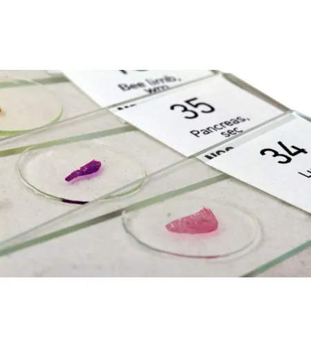 Levenhuk N80 NG "See it all" Slides Set