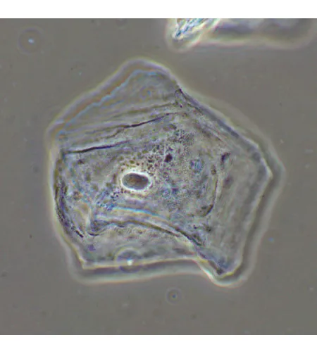 MAGUS SPH2 faasikontrastseade