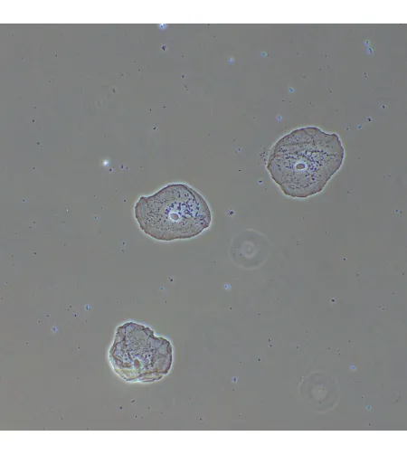 MAGUS PH2 faasikontrastseade