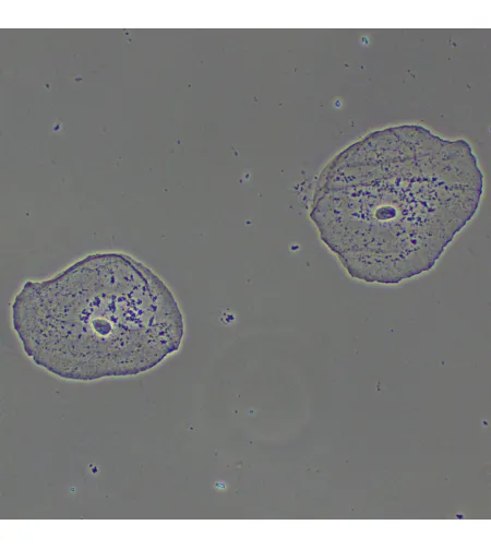 MAGUS PH2 faasikontrastseade