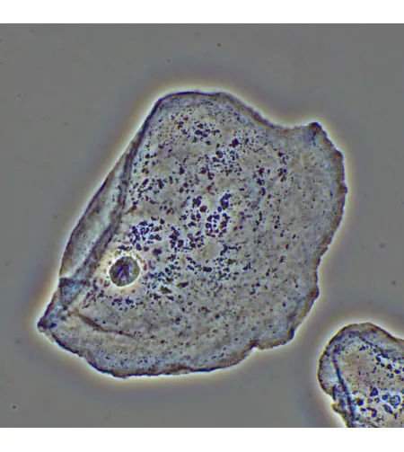 MAGUS PH2 faasikontrastseade