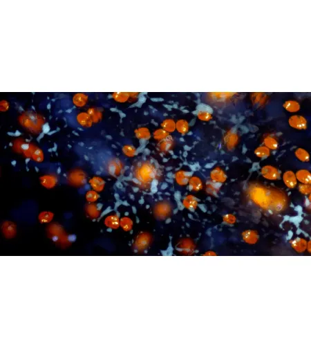 BRESSER MikroCamII 9MP 4K 1'' Microscope Camera