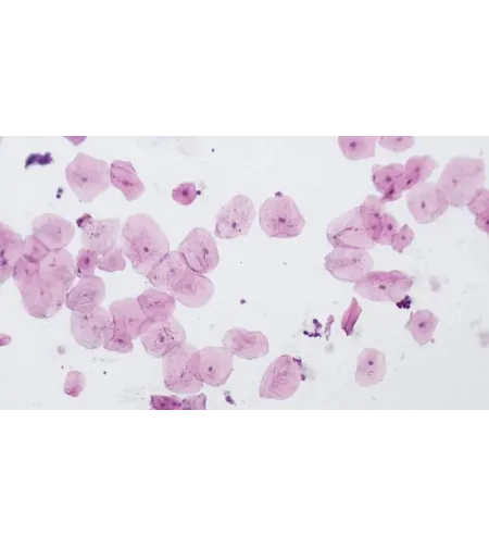 BRESSERi ettevalmistatud slaidid kõrge kvaliteediga 10 tk komplekt